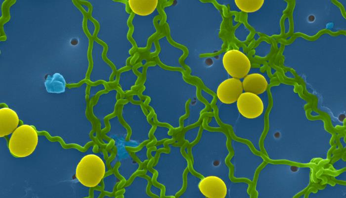 Leptospira