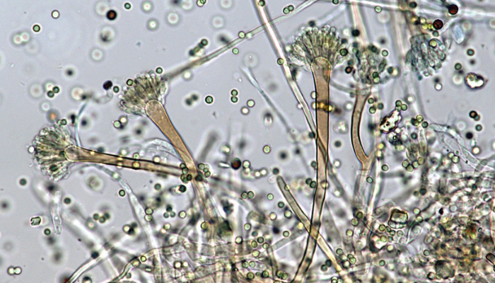 Aspergillus
